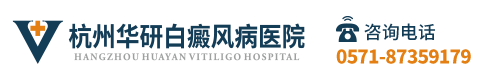 杭州白癜风
