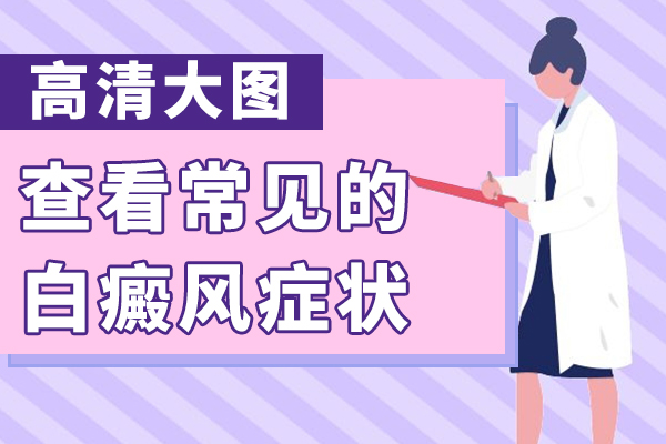 有的白癜风会不会遗传给孩子?